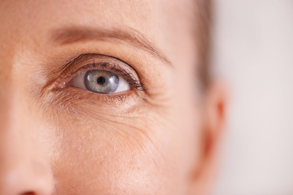 UNDER-EYE AGEING