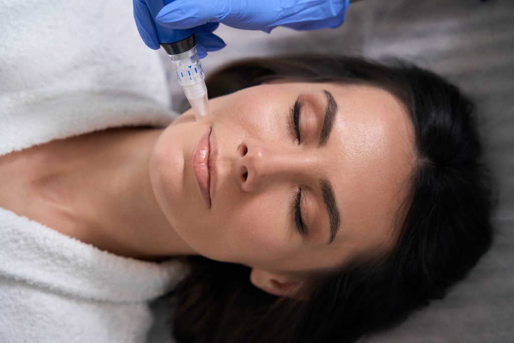 Microneedling