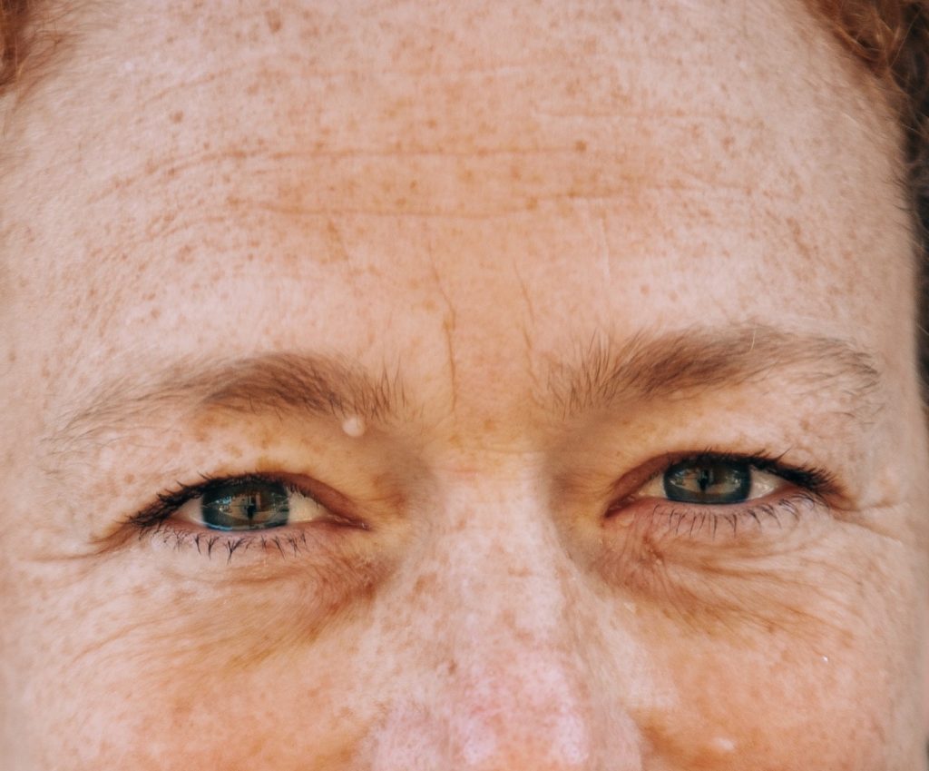 Forehead, frown and eye wrinkles