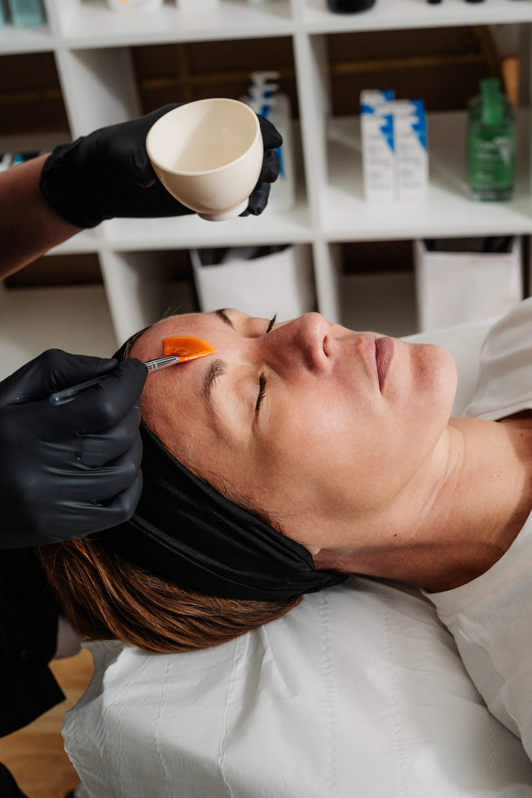 Skin Peel Treatments Brighton and Hove Noaem Skin Aesthetic Clinic