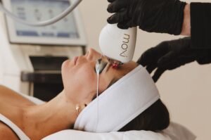 Moxi laser treatment Noaem skin Brighton Hove