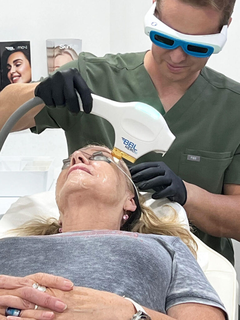 BBL HEROic Treatment at Noaem Skin Brighton and Hove