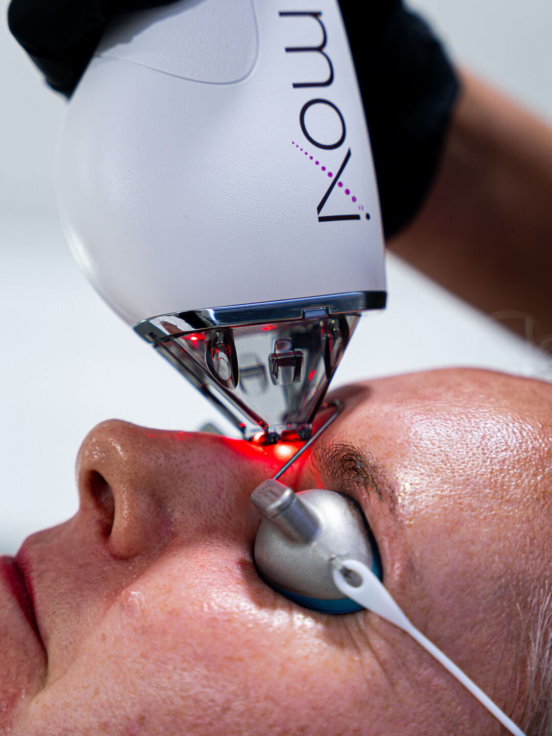 Light and Laser Treatments at Noaem Skin