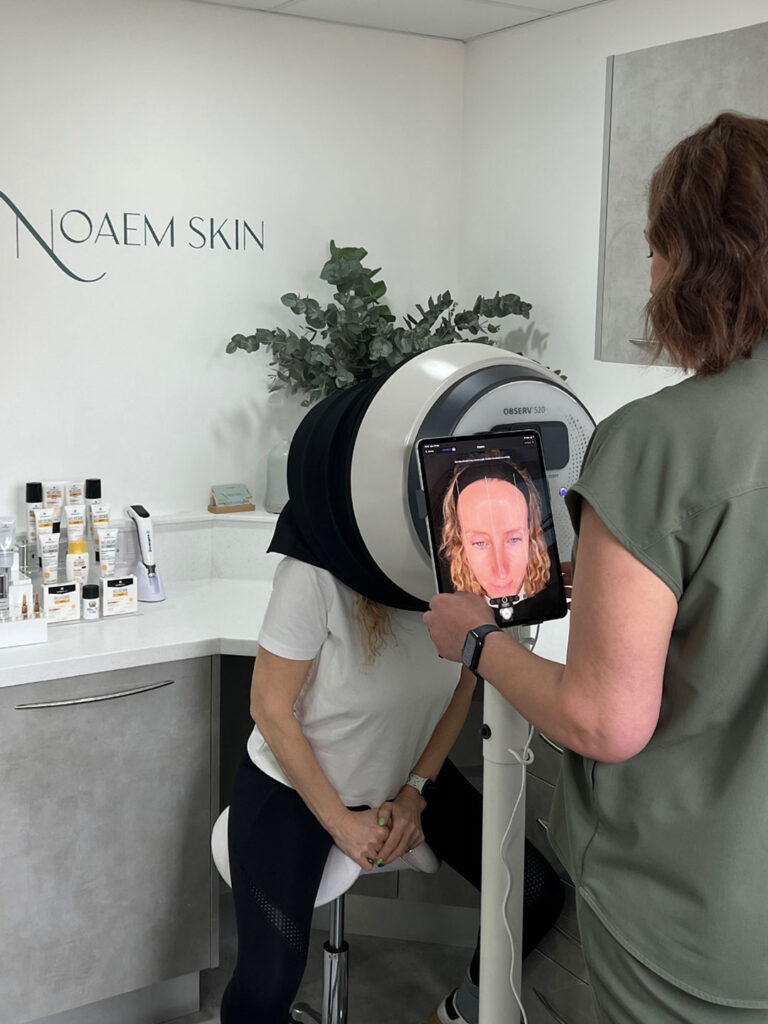Observ 520 Skin Scanner at Noaem Skin Clinic