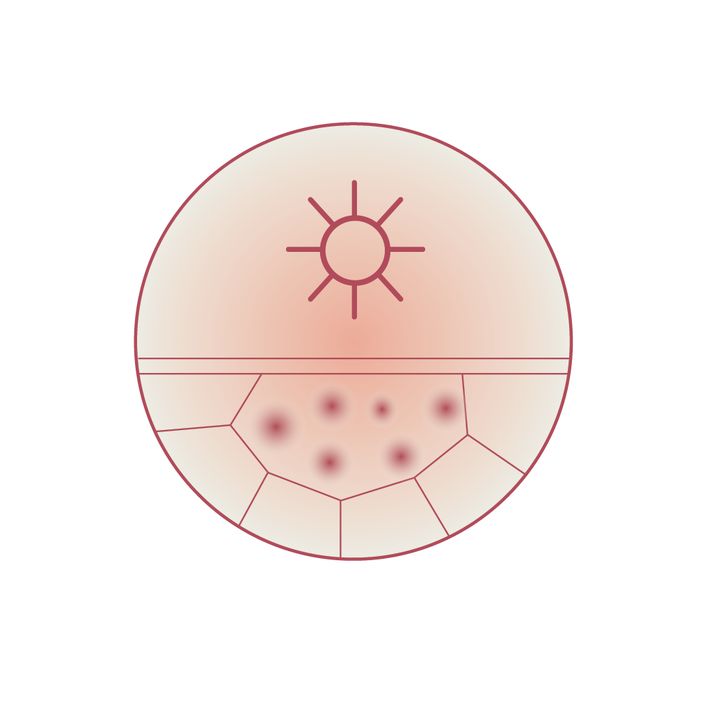Pigmentation & Sun Damage
