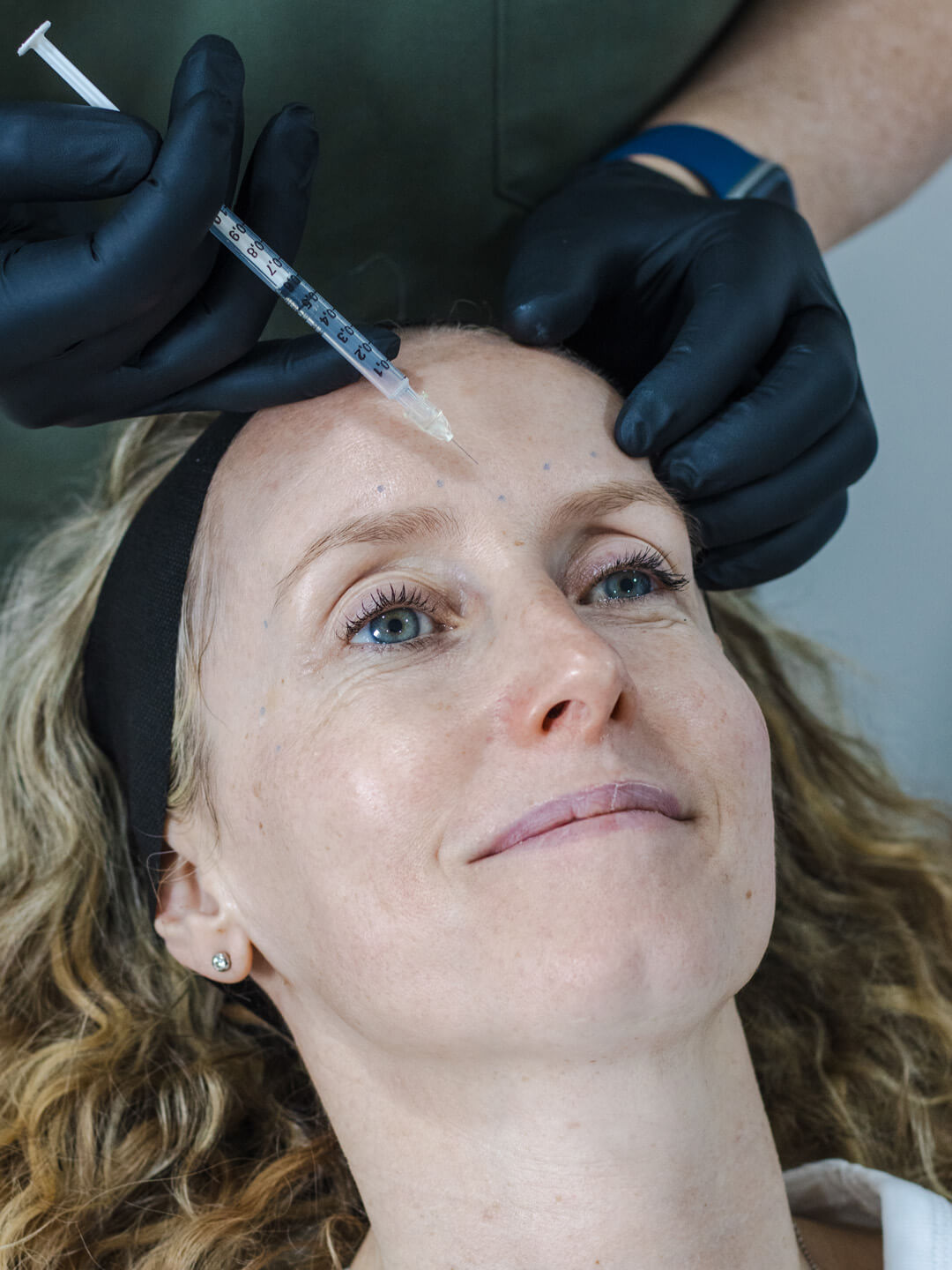 Botulinum toxin Botox injections Brighton and Hove
