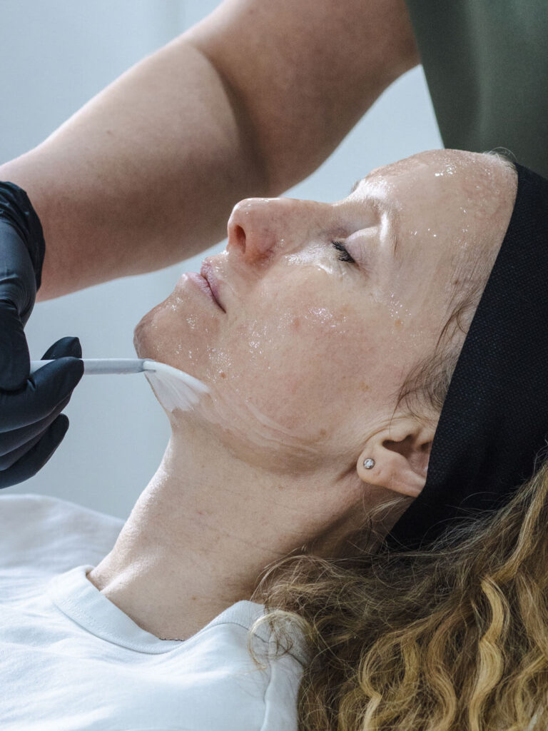 Clinical Skin Peels at Noaem Skin Brighton and Hove